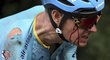 Jakob Fuglsang dojížděl první etapu Tour de France potrhaný s krvavým čůrkem ve tváři