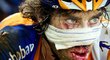 Nizozemský cyklista Laurens ten Dam pokračuje v Tour de France i po hrůzostrašném pádu, který ho nakonec stál "jen" osm stehů