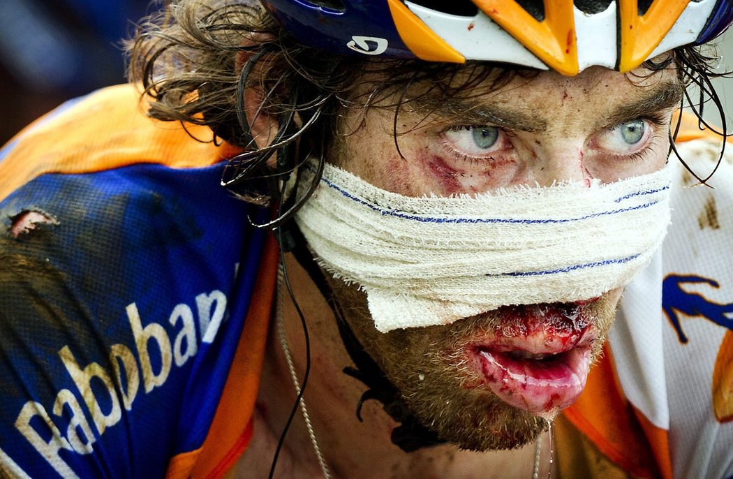 Nizozemský cyklista Laurens ten Dam pokračuje v Tour de France i po hrůzostrašném pádu, který ho nakonec stál &#34;jen&#34; osm stehů