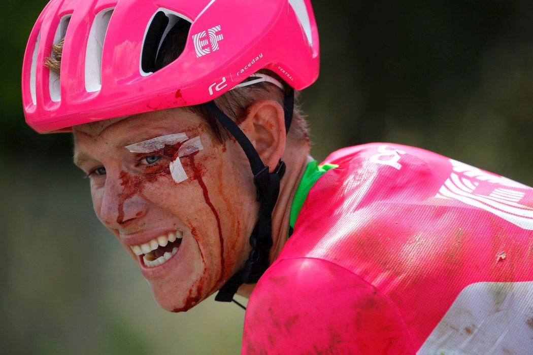 Celý od krve a se zlomenou lopatkou. Přesto Lawson Craddock dokázal dokončit už čtyři etapy Tour de France.