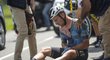 Zdrcený Mark Cavendish po pádu odstoupil