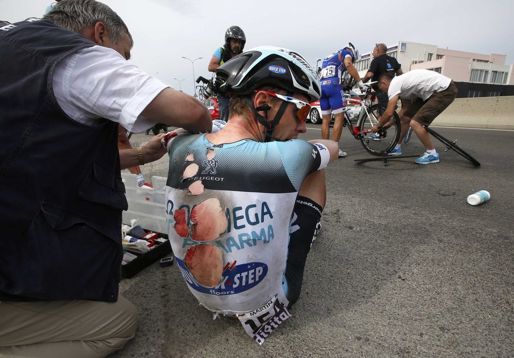 Ošklivě sedřený Tony Martin po hromadném pádu v první etapě Tour de France