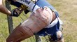 Masakr na Tour: Cyklistu rozpáral ostnatý drát