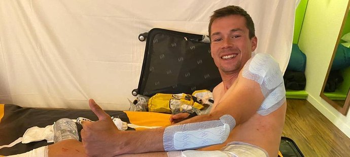 Primož Roglič ukázal, že má po pádu ve třetí etapě Tour de France zafáčované skoro celé tělo...