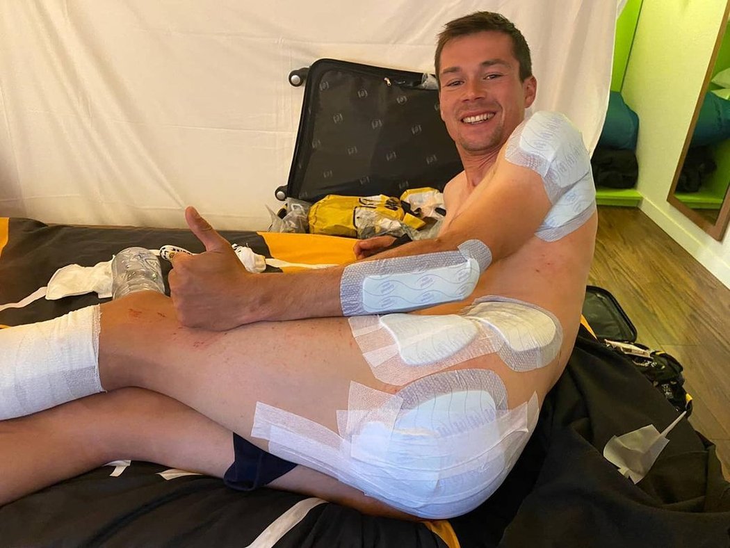 Primož Roglič ukázal, že má po pádu ve třetí etapě Tour de France zafáčované skoro celé tělo...