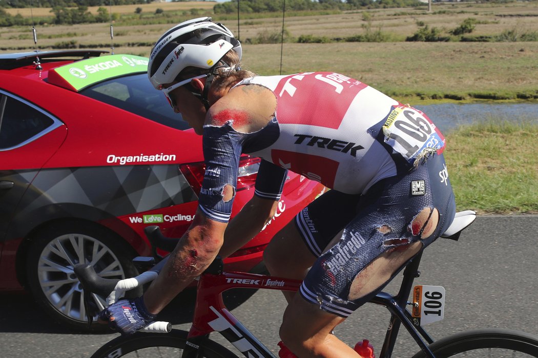 Sedřený Toms Skujins pokračuje po pádu v 10. etapě Tour de France