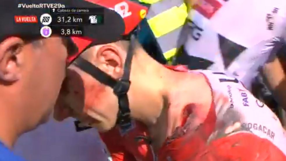 Tadej Pogačar utrpěl při pádu na Vueltě otřes mozku, zlomeniny klíční kosti i sedmého krčního obratle