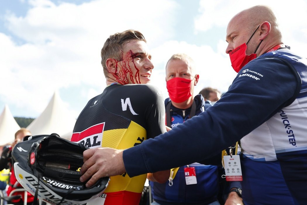 Remco Evenepoel po vítězném dojezdu třetí etapy Vuelty získal krvavý šrám ve tváři