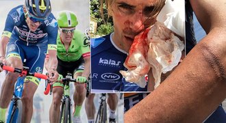 Drsný útok na cyklistu! Francouze Offreda při tréninku zbili a pořezali
