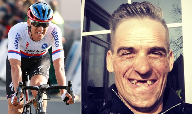 Cyklista Zdeněk Štybar se na sociální síti pochlubil vtipnou fotkou... O zuby přišel už na podzim, ale v posledním závodě Kolem Flander si musel vyndat i uvolňující se můstek