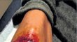 Ošklivé zranění cyklisty Frana Ventosy při závodu Paříž-Roubaix