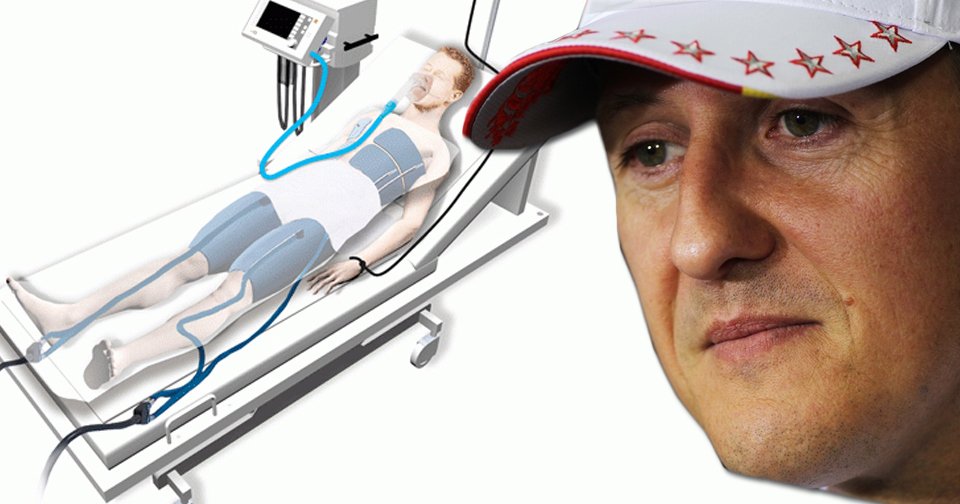 Jak lékaři udržují při životě Michaela Schumachera?