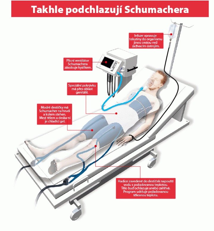 Takhle nějak vypadá péče o Michaela Schumachera v umělém spánku