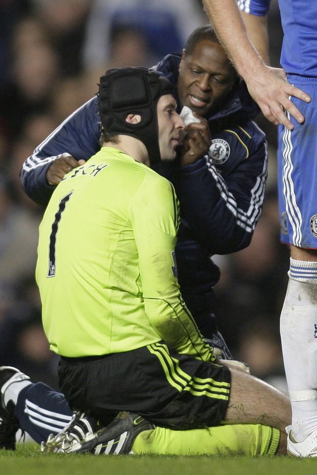 Petr Čech utrpěl krvavé zranění Petr Čech utrpěl krvavé zranění