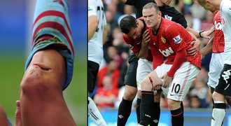 FOTO: Hrůzné zranění! Stejně jako Rooney má vyvrtanou díru do nohy