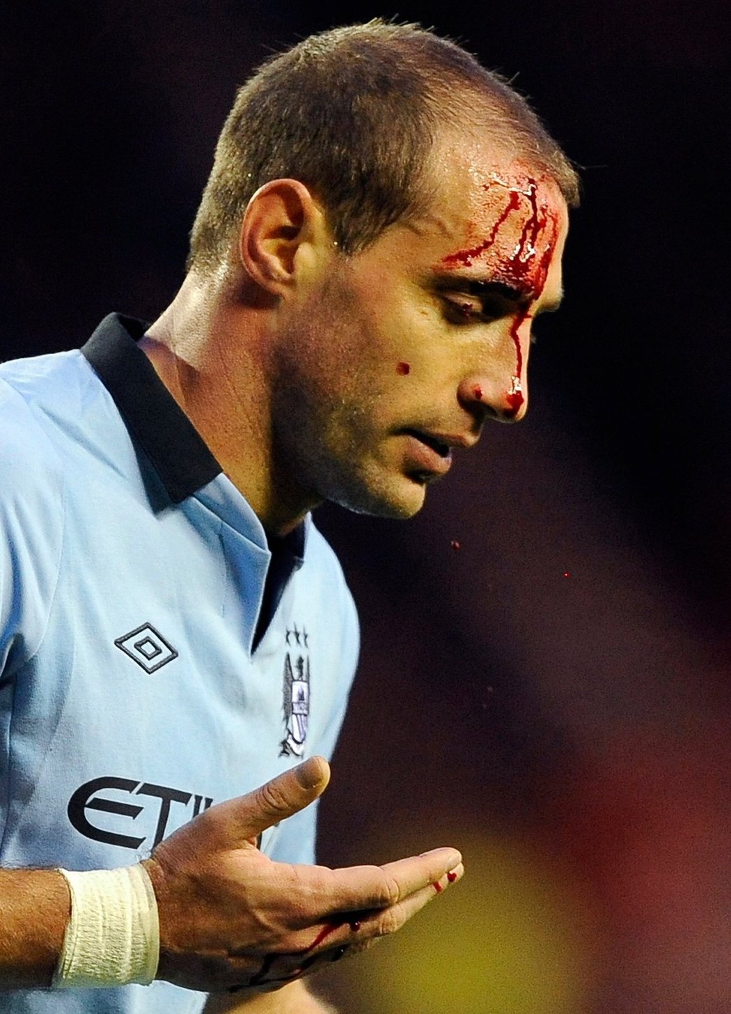 Pablo Zabaleta z Manchesteru City je sice tvrďák, ale tenhle šrám zatraceně bolel