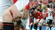 Wayne Rooney skončil s krvavým šrámem a čtyři týdny si nezahraje