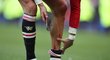 Zraněná noha Cristiana Ronalda ze zápasu proti Evertonu