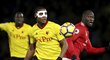 Záložník Watfordu Marvin Zeegelaar nastoupil do utkání proti Manchesteru United s ochrannou maskou na obličeji