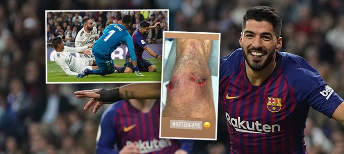 Zkáza Realu! Ramos se vztekal na spoluhráče, smolař si zničil koleno Zkáza Realu! Ramos se vztekal na spoluhráče, smolař si zničil koleno