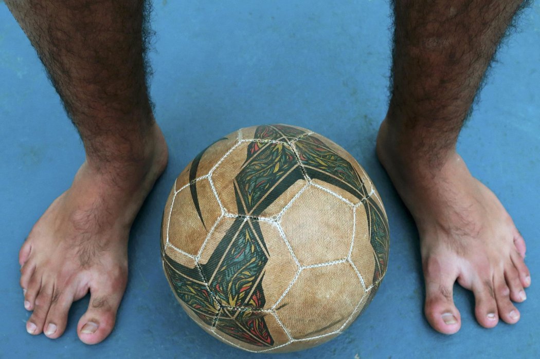 Členové brazilské rodiny se narodily s vrozenou vadou, na rukách i nohách mají šest prstů. Teď si přejíé, aby jejich země získala šestý titul světových šampionů 