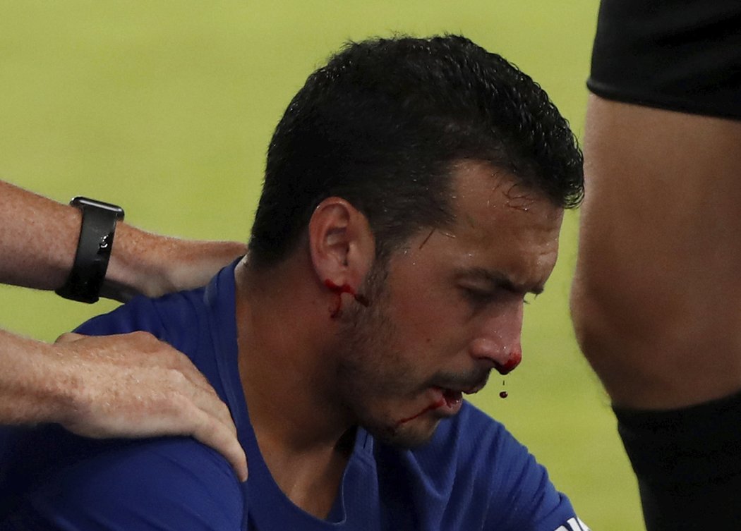 Útočník Chelsea Pedro vyšel ze zápasu s Arsenalem s několika frakturami