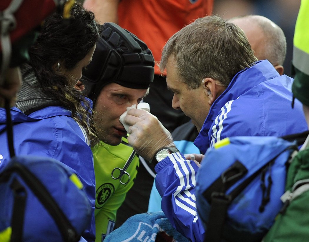 Lékaři Chelsea ošetřují Petra Čecha. Vypadalo to na zlomený nos, český brankář ale nakonec utkání dochytal.