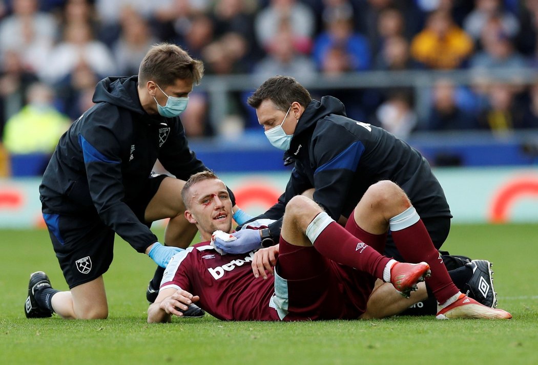 Tomáš Souček po zásahu kopačkou do obličeje musel v duelu s Evertonem střídat