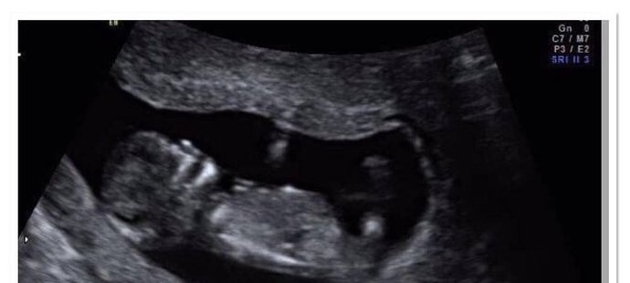 Gino van Kessel se pochlubil ultrazvukem a i snímky, na kterých je se svou přítelkyní jako dítě