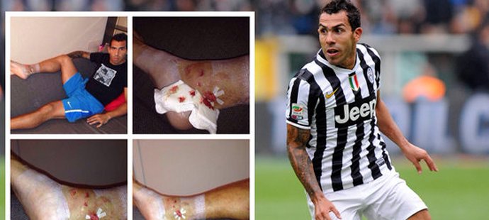 Útočník Juventusu Turín Carlos Tévez musel ustát ošklivý faul, který mu pošramotil kotník