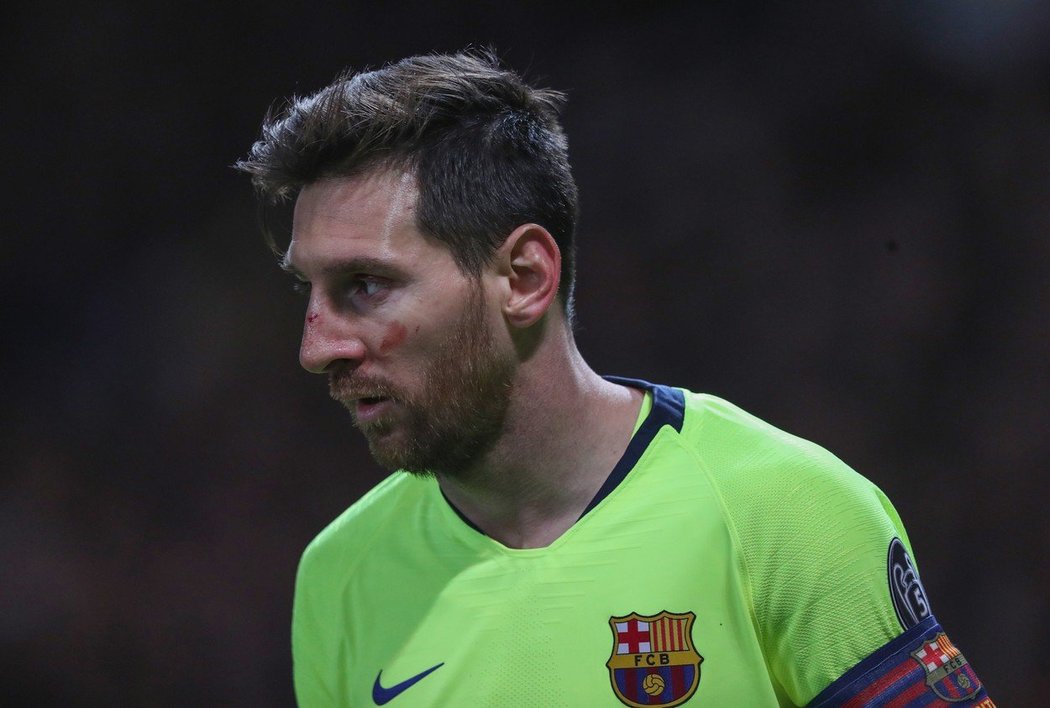 Lionel Messi po úderu od Chrise Smallinga dohrál otřesený a s krvavým šrámem