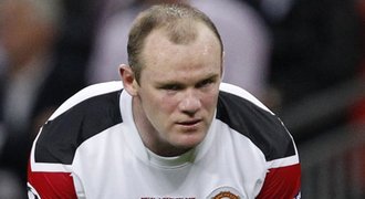 Plešatějící Rooney: Transplantace vlasů!