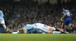 Zraněný záložník Manchesteru City Kevin De Bruyne v utkání s Evertonem