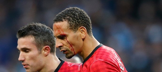 Rio Ferdinand si z vyhroceného derby odnesl krvavý šrám