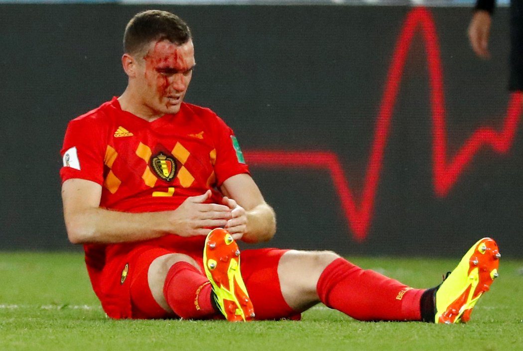 Belgičan Thomas Vermaelen si odnesl krvavé zranění z utkání s Anglií