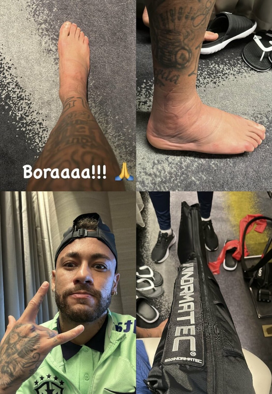 Neymar v sobotu ukázal, jak vypadá jeho kotník
