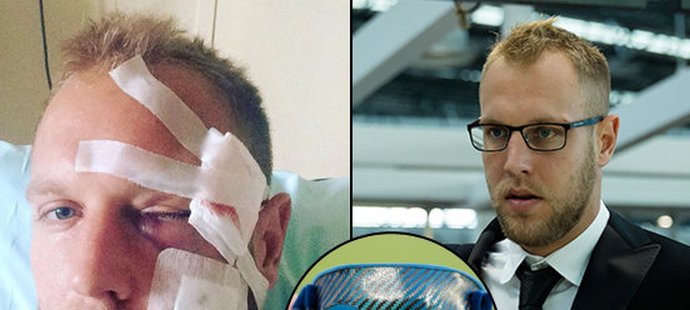 Plzeňský záložník Daniel Kolář se po zranění vrací na hřiště, musí hrát s ochranou maskou