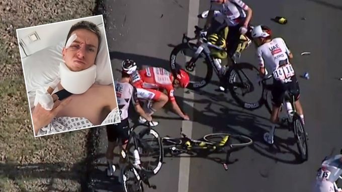 Po otřesu mozku ohrožený start na MS. Proč se Pogačarova operace musela odložit? Po otřesu mozku ohrožený start na MS. Proč se Pogačarova operace musela odložit?
