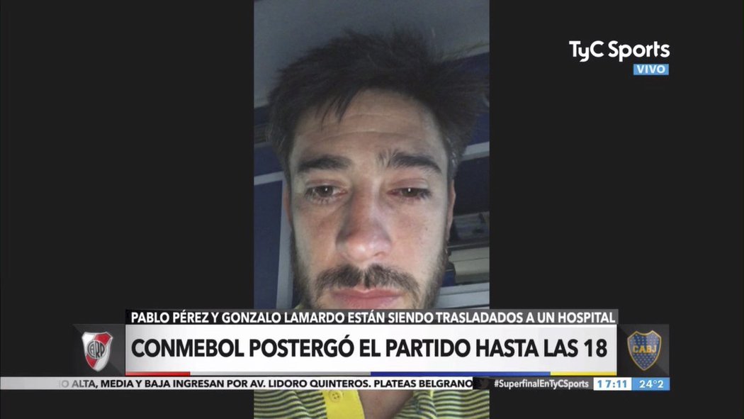Pablo Pérez dostal zásah slzným plynem a do oka se mu zapíchl střep