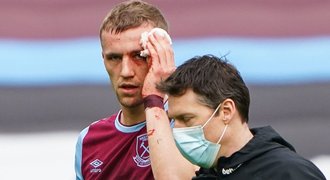 Zkrvaveného Součka ošetřovali. West Ham vyhrál. Slaví týmy z Manchesteru