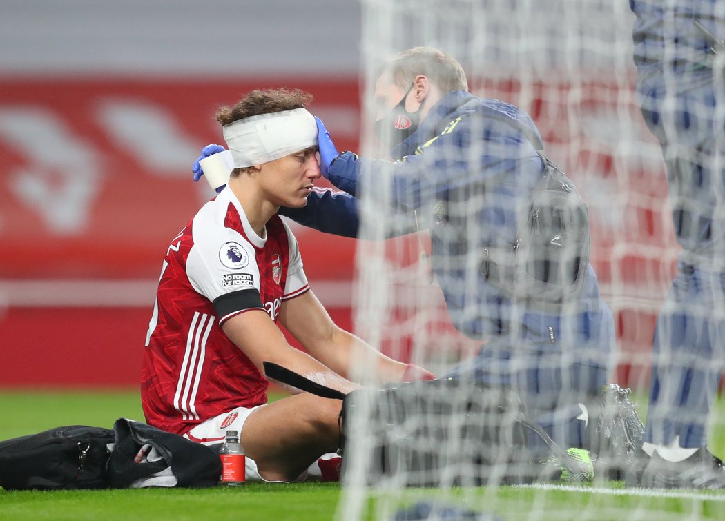 David Luiz hrál i po děsivé srážce, přes bandáž mu později začala téct krev