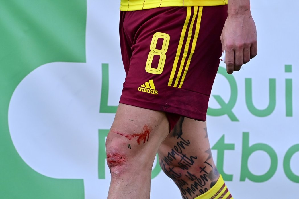 David Pavelka utrpěl proti Stuttgartu krvavé zranění
