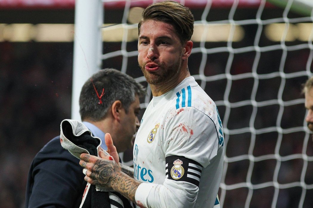 Zakrvácený Sergio Ramos, kterému obránce Lucas zlomil nos