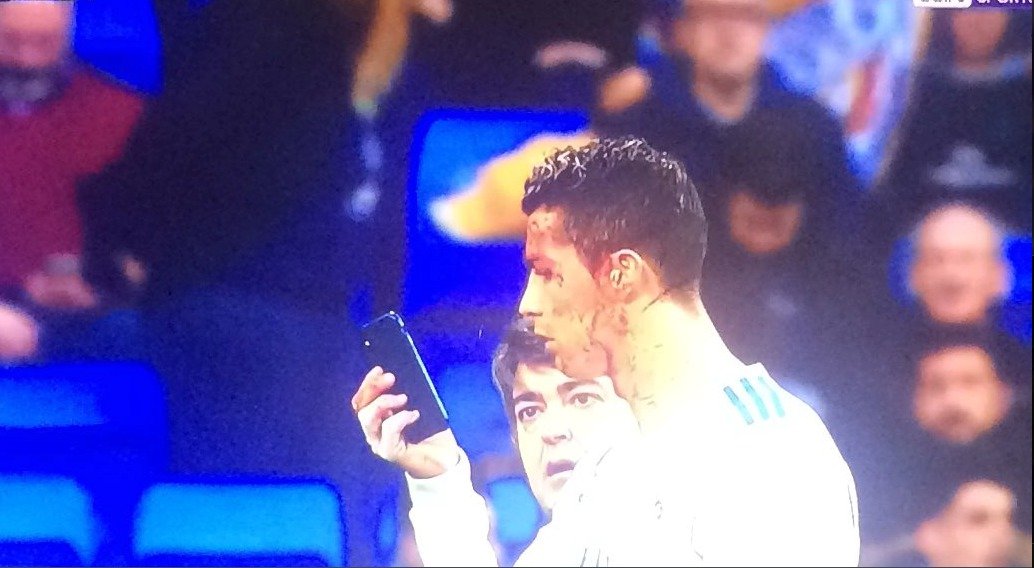 Ronaldo si kontroloval tvář v telefonu lékaře Realu přímo na hřišti