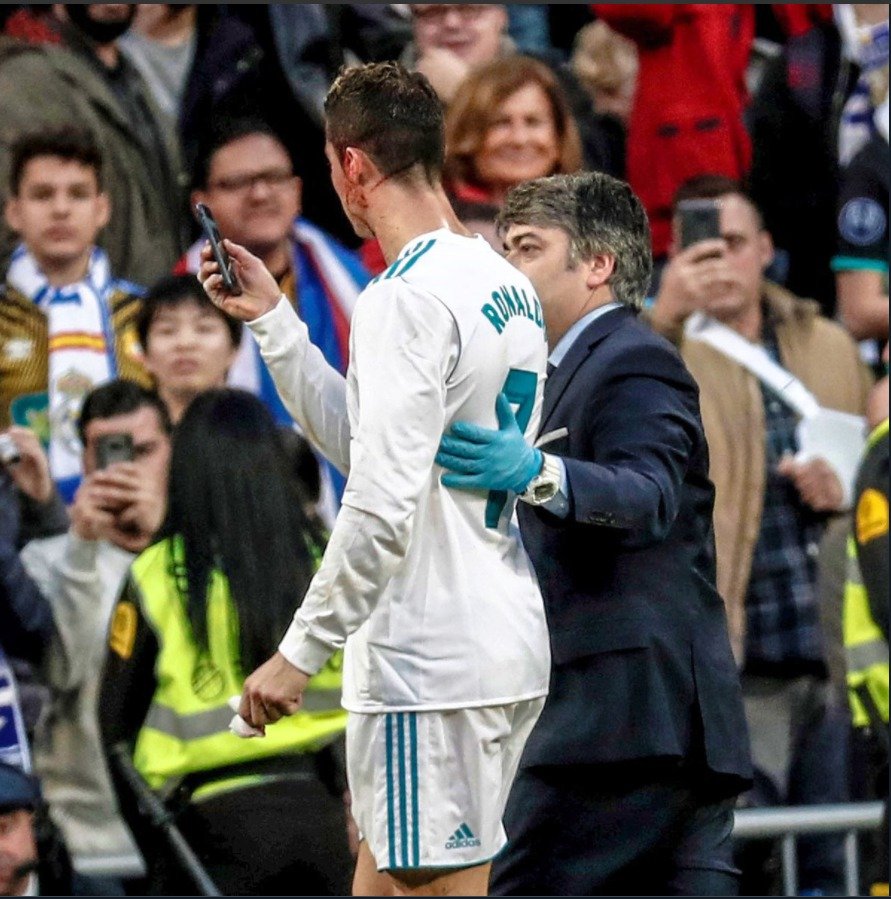 Ronaldo si kontroloval tvář v telefonu lékaře Realu přímo na hřišti