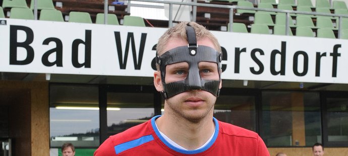 Michal Kadlec musel po napadení dvěma fanoušky na fotbal nosit masku. Teď se dočkal satisfakce v podobě trestu pro oba násilníky