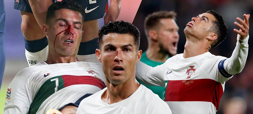 Cristiano Ronaldo v zápase proti Čechům pálil šance, zahrál rukou ve vápně a střetl se s Tomášem Vaclíkem