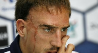 Skandál: Ribérymu hrozí konec v reprezentaci