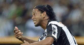 Jiný vzhled, tvar i barva. Ronaldinho si nechal spravit předkus