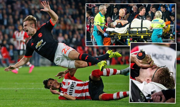 Ošklivé zranění obránce Manchesteru United Luka Shawa, které znamená zlomenou nohu